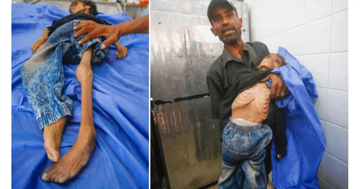 Gazze’de açlıktan ölen kızın amcası, Batı’da olsa dünya ayağa kalkardı dedi.