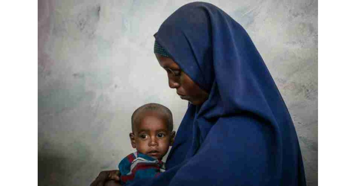 UNICEF'ten açıklama: Yemende 400 bin çocuk yetersiz beslenmeden dolayı her an ölebilir