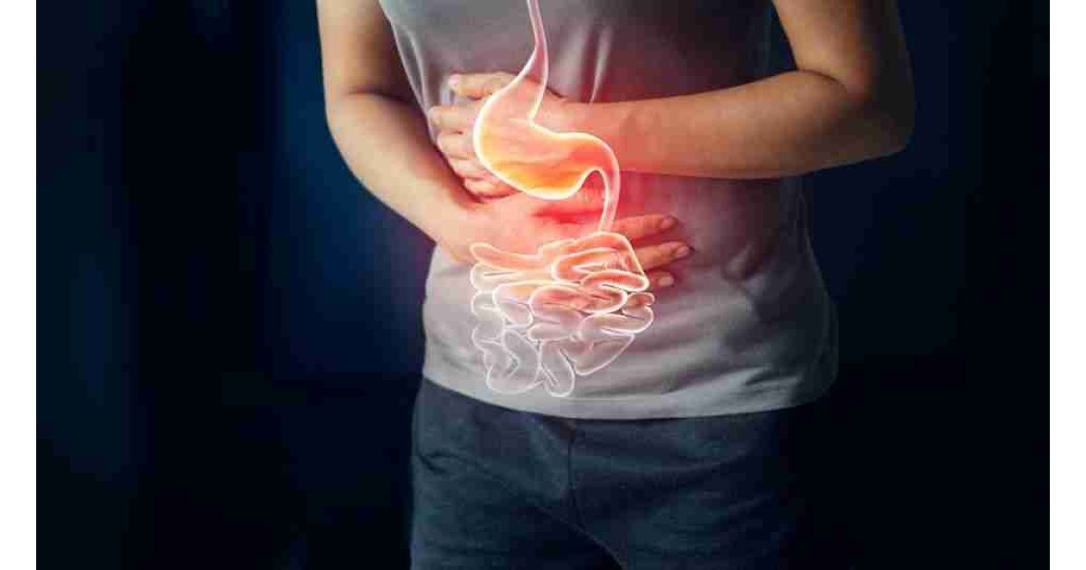 Mide yanması neden olur? Nasıl geçer? Mide yanmasına ne iyi gelir?