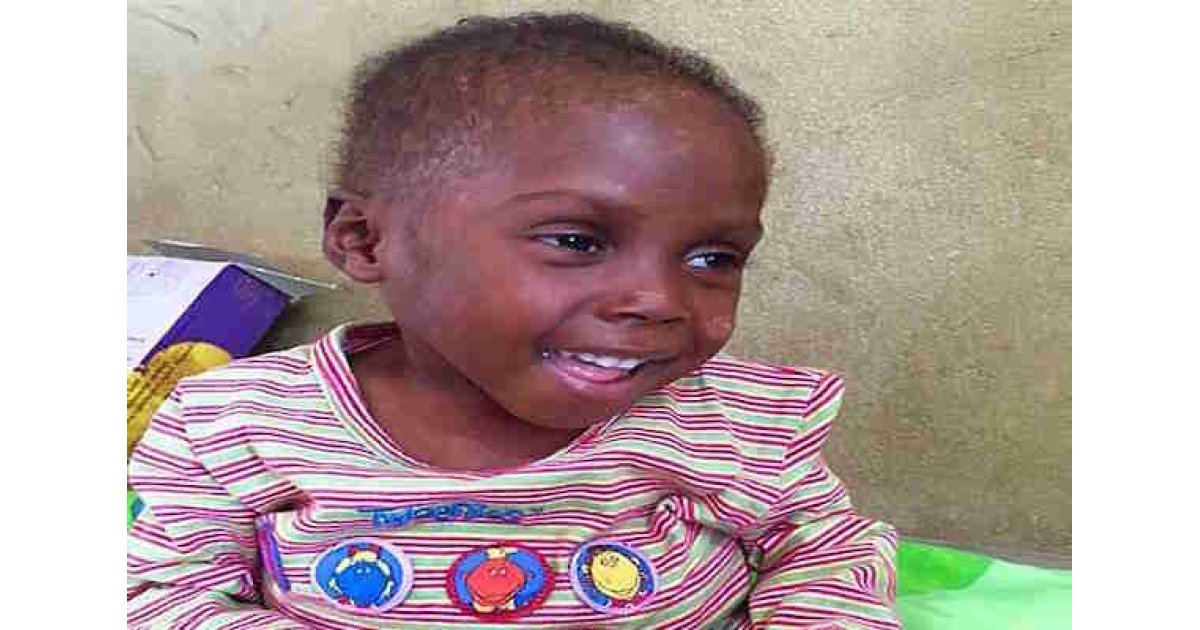 Cadı Diye Sokağa Atılan Henüz 2 Yaşındaki Umut'un Umut Dolu Hikayesi