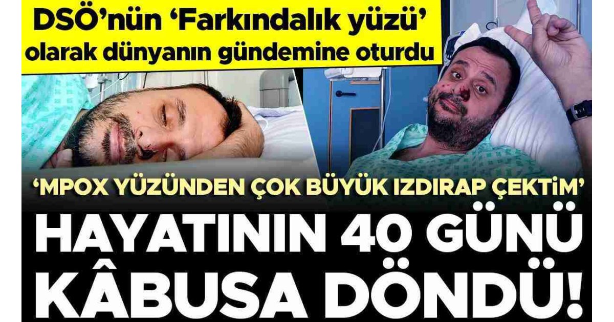 Avrupa'daki ilk hastalardandı... Mpox hastalığına yakalanan Harun Tulunay, yaşadıklarını anlattı: Çok büyük ızdırap çektim