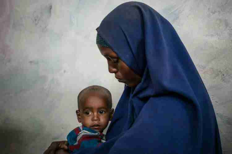 UNICEF'ten açıklama: Yemende 400 bin çocuk yetersiz beslenmeden dolayı her an ölebilir