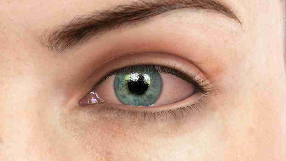 Göz batması neden olur, nasıl geçer? Göz batmasına ne iyi gelir?