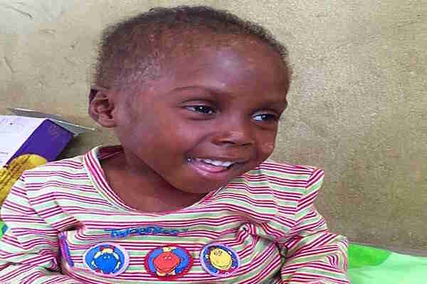 Cadı Diye Sokağa Atılan Henüz 2 Yaşındaki Umut'un Umut Dolu Hikayesi