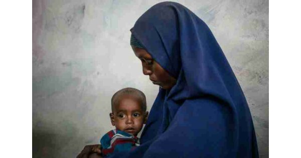 UNICEF'ten açıklama: Yemende 400 bin çocuk yetersiz beslenmeden dolayı her an ölebilir
