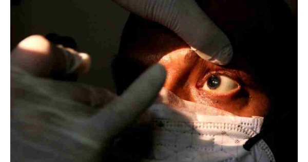 Hızlı yayılan kara mantar hastalığının tedavisi: Bir gözünü çıkartmak!
