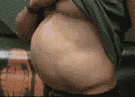 Abdominal definition