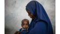 UNICEF'ten açıklama: Yemende 400 bin çocuk yetersiz beslenmeden dolayı her an ölebilir